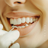v-Dental Clinic