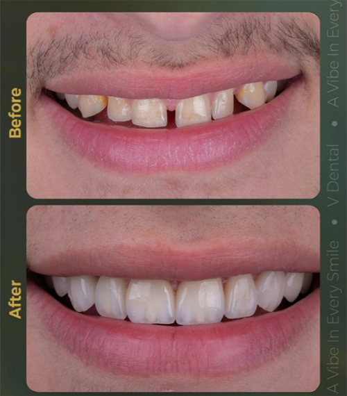v-Dental Clinic