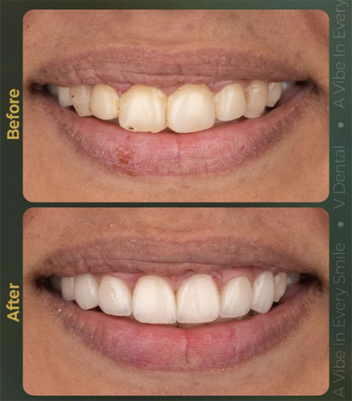 v-Dental Clinic